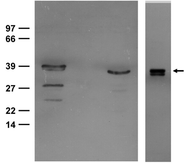 Anti-Arginase-1 Antibody | ABS535